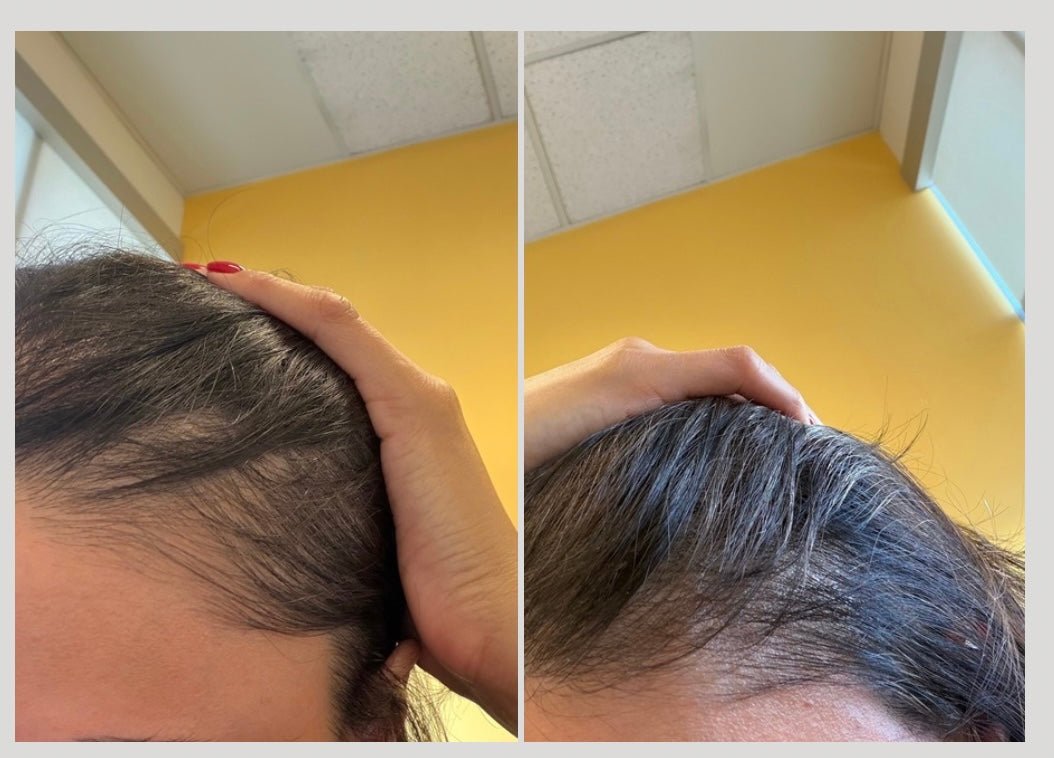 Roza Roots Hair Growth Oil: Natural DHT Blocker for Thicker, Fuller Hair. Bundle and save!