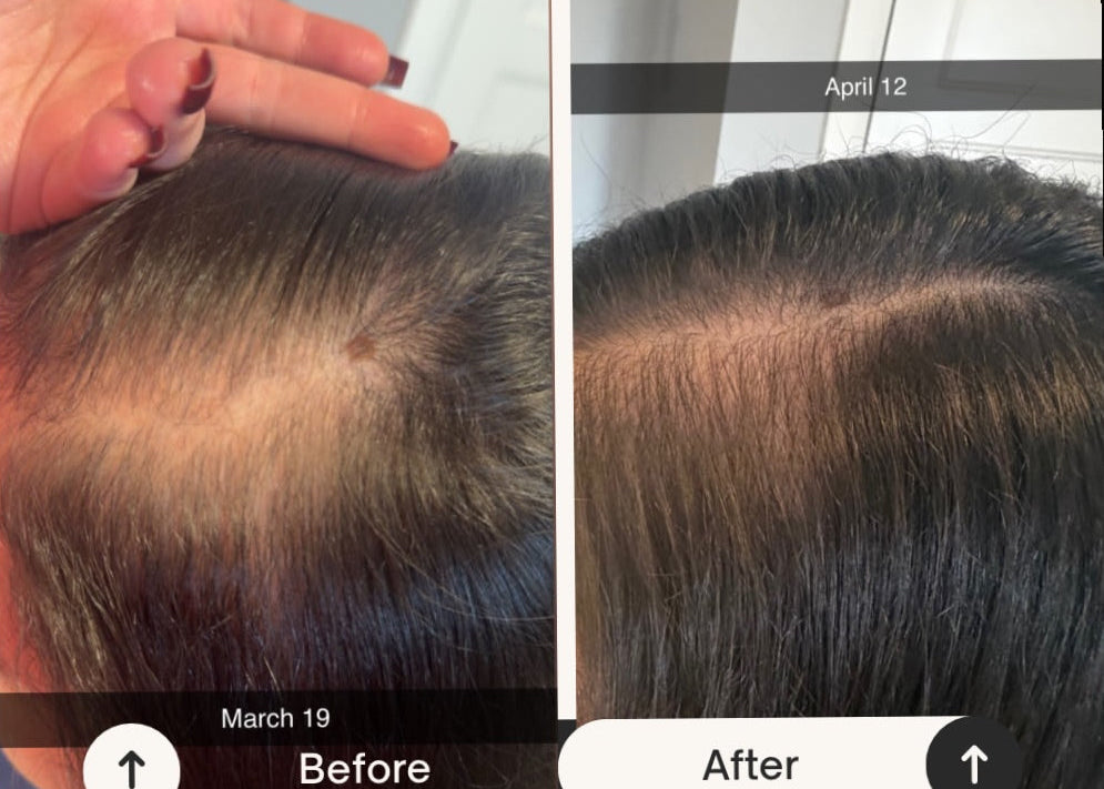 Before and after hair transformation showing healthier-looking hair after a consistent Roza Roots botanical hair care routine.