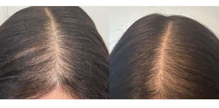 Roza Roots Hair Growth Oil: Natural DHT Blocker for Thicker, Fuller Hair